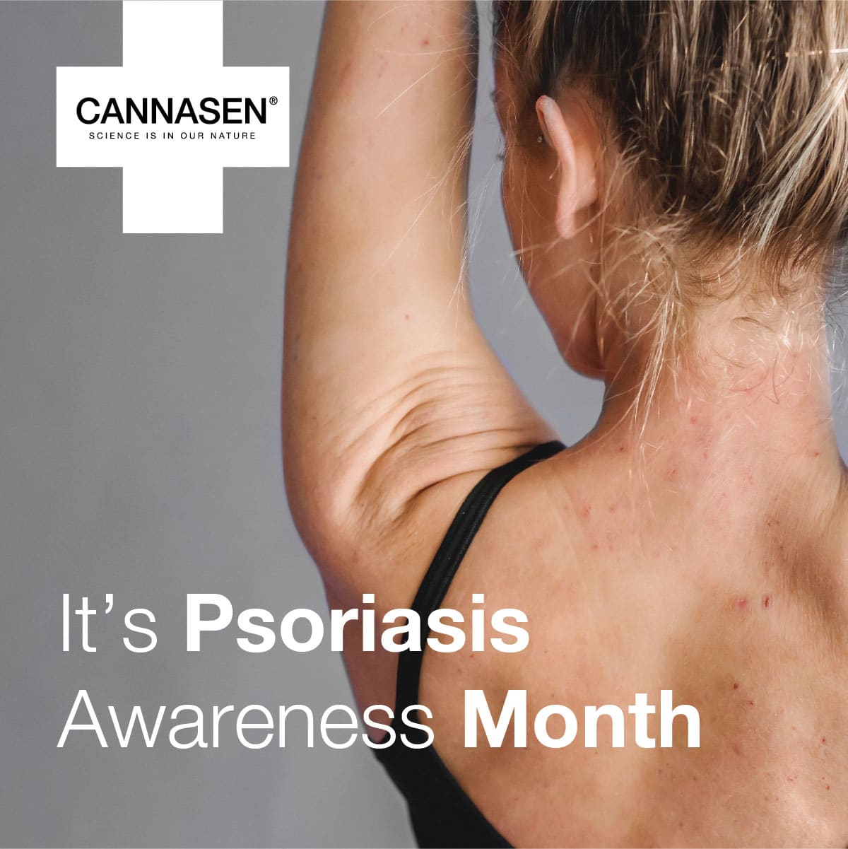 3.Psoriasis Awareness